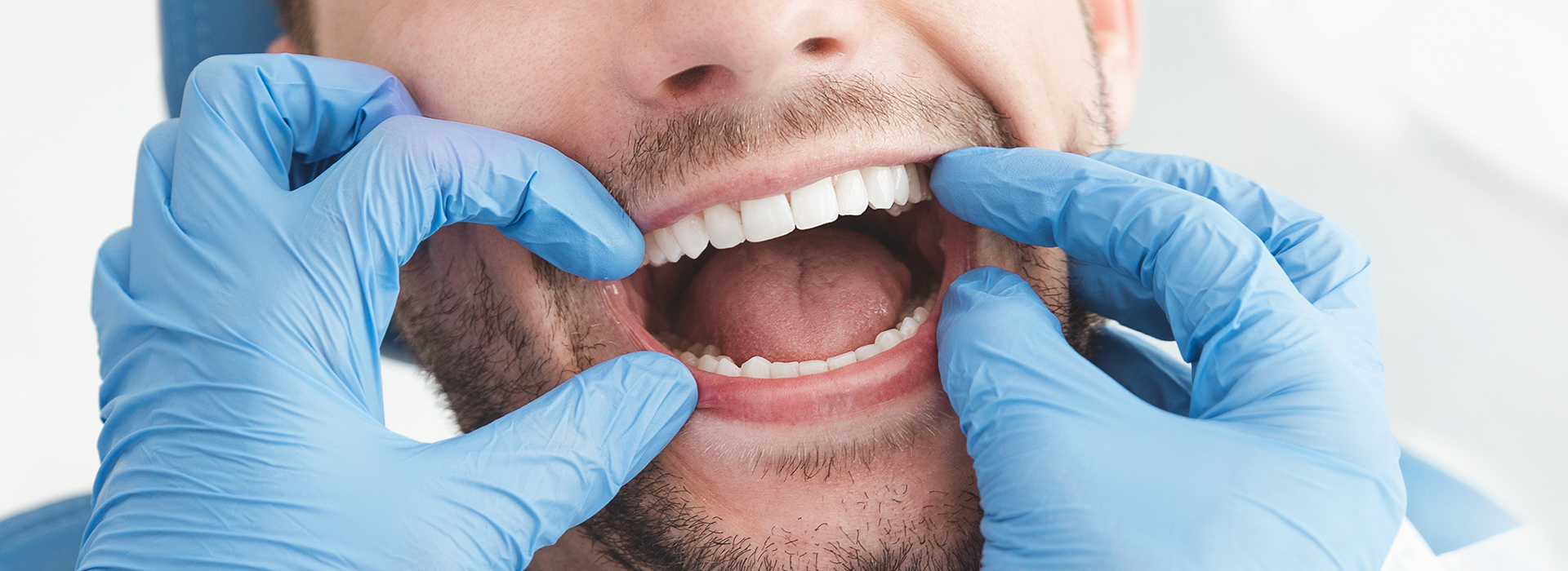 The image is a photograph of a person with an exaggeratedly large mouth, wearing blue gloves and sitting in front of a medical setting.