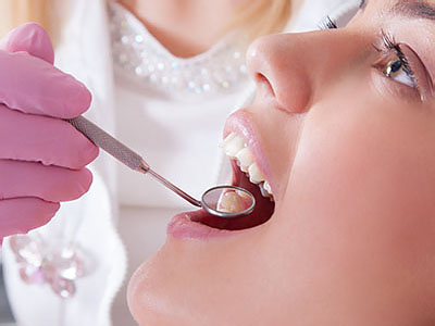 The image shows a person receiving dental care, with a focus on a dental hygienist or dentist using a drill to clean teeth.